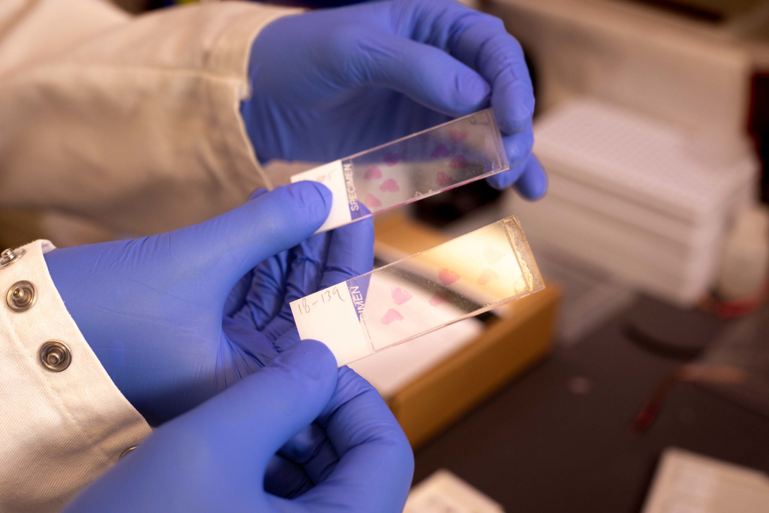Understanding Inflammation in the Heart