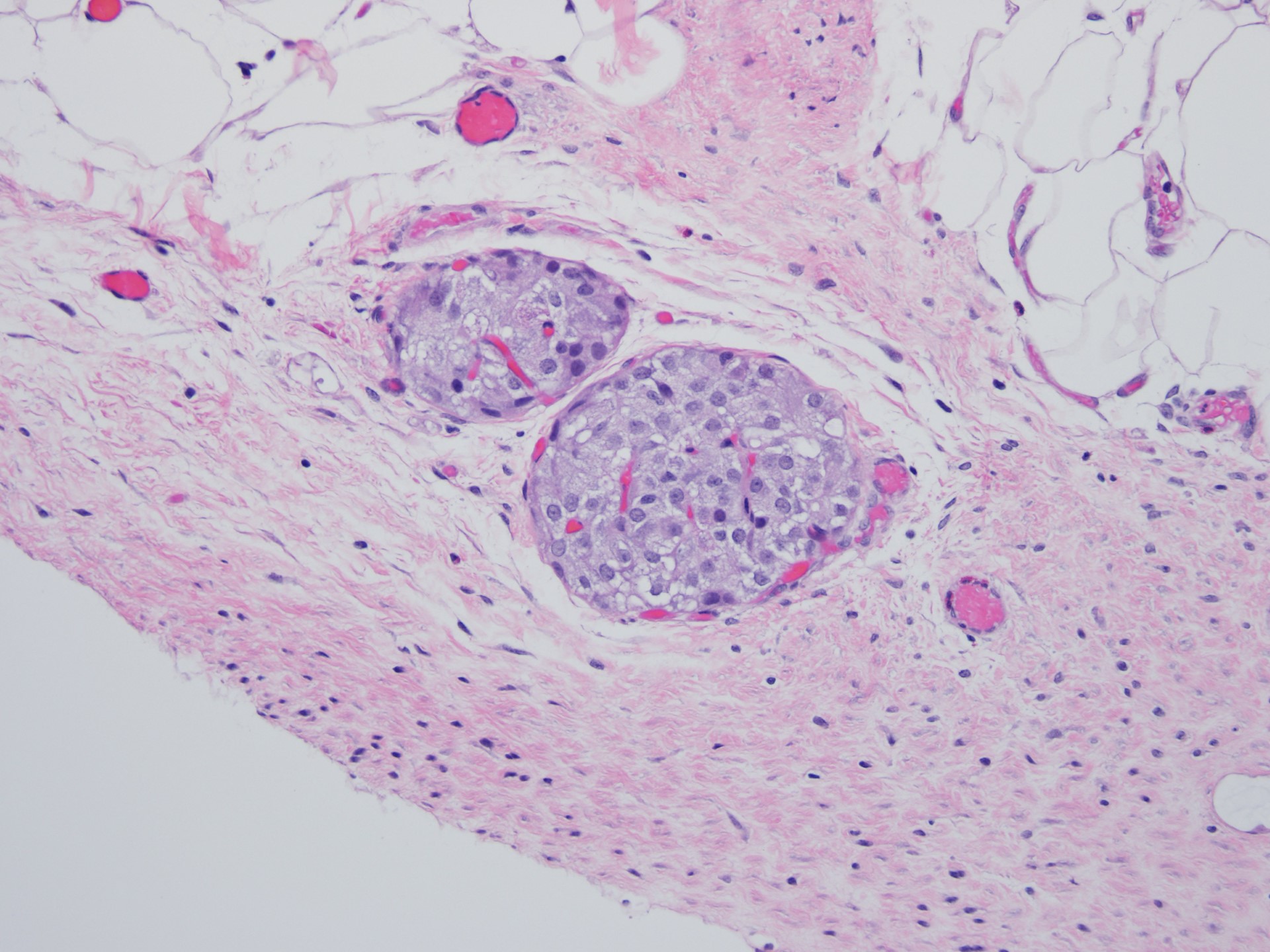 Antioxidant Gel Preserves Islet Function After Pancreas Removal