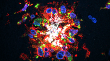 How Alzheimer’s Drugs Work with David Gate, PhD